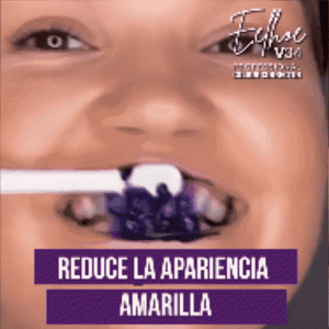 😁 EELHOE V34 🦷