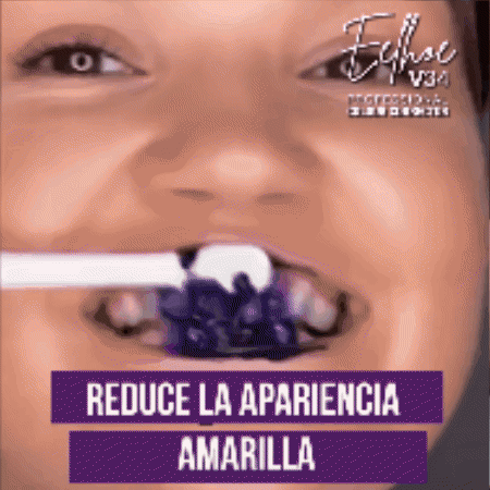 😁 EELHOE V34 🦷